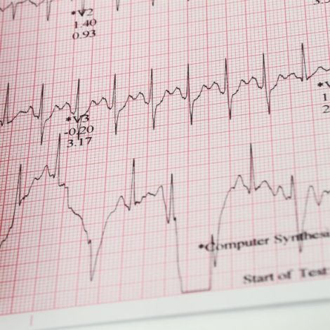 Welch Allyn CP50 ECG Paper - Roll (200 ECGs)